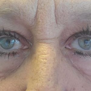 Meet your Posher, Lynn